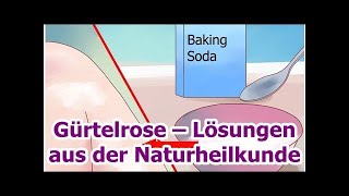 Gürtelrose – Lösungen aus der Naturheilkunde [upl. by Norabel]