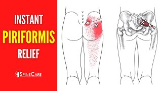 How to Get Rid of Piriformis Pain FOR GOOD [upl. by Hovey]