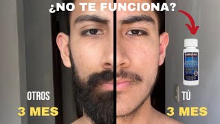 ¡POR ESTAS RAZONES NO TE CRECE BARBA AL USAR MINOXIDIL [upl. by Nekciv]