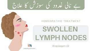 Swollen Lymph Nodes in Neck Homeopathic Treatment  SCROFULA ENLARGED GLANDS  Bioplasgen 22 [upl. by Accire]