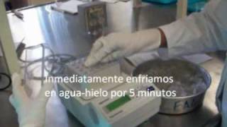 Práctica  Transformación bacteriana con pGLO [upl. by Oirevlis]