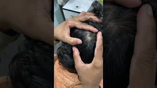 ASMR Wife cleaned husband hair lice 🤪Hair transformation massage 💆 [upl. by Alet]