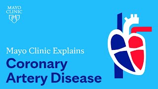 Mayo Clinic Explains Coronary Artery Disease [upl. by Ahseel41]