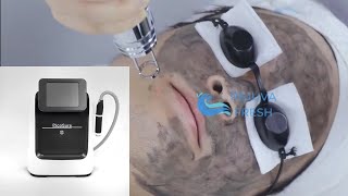 Black Doll Facial Treatment  How to use Pico Laser Tattoo Removal Machine  Operation Demo [upl. by Omrelliug365]