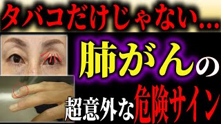 【肺がん】絶対に見逃さないで！タバコだけじゃない！意外すぎる肺がんの症状とは？【予防医学】【医学】【健康】【医療】【本の要約】【がん】 [upl. by Thurnau277]