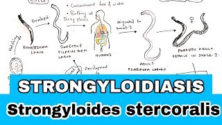 Strongyloidiasis  Life cycle Symptoms Treatment  Strongyloides stercoralis  Bio science [upl. by Earlene821]