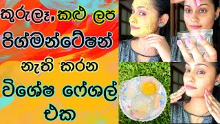 කුරුලෑපිග්මන්ටේෂන්කළු ලප සුව කරන විශේෂ ෆෙෂල් එකDark SpotsPigmentationAcne Brightening facial [upl. by Manella]