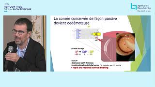 Session « Innovation dans la greffe de tissus  focus sur la cornée » [upl. by Monte]