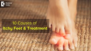 10 CAUSES OF ITCHY FEET How to get relief  Right Treatment  Dr Urmila Nischal Doctors Circle [upl. by Aceber851]