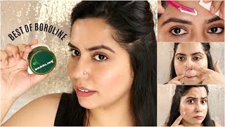 Top 5 Surprising Uses of BOROLINE🤔  Remove Pimple amp Acne in 3 Days  Beauty Hacks [upl. by Guod960]