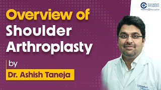 Overview of Shoulder Arthroplasty by Dr Ashish Taneja  Orthopedic Residency [upl. by Shimkus962]