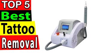 Best Laser Tattoo Removal In 2024 TOP 5 [upl. by Marbut]