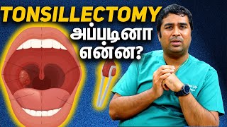 Understanding Tonsillectomy with Dr Vignesh Gokul  Expert ENT Explains in Tamil [upl. by Yssor]