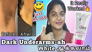 Qraa Dark Underarm Whitening cream Review  💯 Worked🔥 Permanent Solution for Dark Underarm  qraa [upl. by Nniroc735]