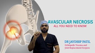 What is AVNAvascular necrosis of femoral head in Marathi  By DrJaydeep Patil [upl. by Kirit564]