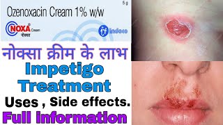 Noxa cream 1 use in hindi  Ozenoxacin 1 uses  Side effects  Best impetigo cream [upl. by Nolrev]