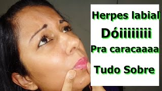 HERPES LABIAL  REMÉDIO CASEIRO CURA RÁPIDA [upl. by Kcirdahs]