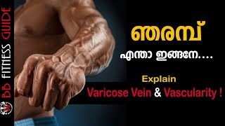 Varicose Vein and Vascularity  Malayalam Certified Fitness Trainer Bibin [upl. by Namhar]