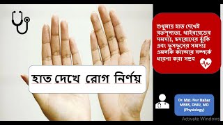 হাত দেখে রোগ নির্ণয় DrMonalisha tremor anemia healthtips Koilonychia Leukonychia clubbing [upl. by Mauralia351]