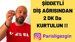 Şiddetli Diş Ağrısı Nasıl Geçer  2 dakika da Diş Ağrısına Kesin Çözüm [upl. by Culhert]