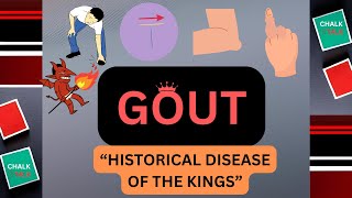 GOUT UNDERSTANDING THE DISORDER [upl. by Aizitel413]