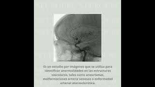 ARTERIOGRAFIA CEREBRAL DIAGNOSTICA NEUROURC Dr Cristobal Salgado [upl. by Notyep]