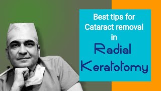 Post RK cataract surgery Radial Keratotomy step by step Dr Kamal B Kapur [upl. by Gwennie427]