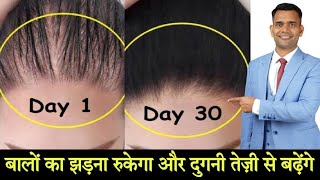 दुगनी  2x  तेजी से बडेंगे बाल  Stop Hair Fall And Promote Hair Growth  बालों का झड़ना रोके [upl. by Laurice915]