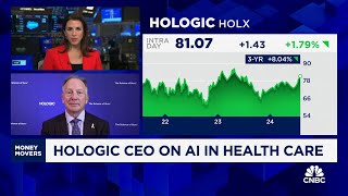 Hologic CEO on earnings beat our Covid work has turbocharged diagnostics business [upl. by Kirwin]