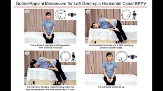 GufoniAppiani Manoeuvre for Left Geotropic Horizontal Canal BPPV [upl. by Eniala142]