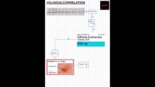 Shorts ClinicalCorrelation NEETNEXTPGFMGEMBBSWPW SYNDROME EBSTEIN ANOMALY LITHIUMPSORIASIS [upl. by Arot862]