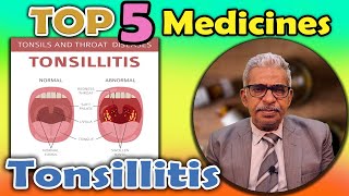 Top 5  Homeopathy Medicines for Tonsillitis  Dr P S Tiwari [upl. by Haidebej]