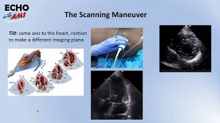 Basic Transthoracic Echocardiography [upl. by Cita878]