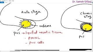 Systemic pathology 18  CNS 2 brain abscess and degenerations  DRSAMEH GHAZY [upl. by Aitam]