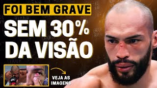 ATUALIZAÇÃO PREOCUPANTE SOBRE BRUNO BLINDADO  WEIDMAN ACEITA REVANCHE NO UFC [upl. by Pasquale237]