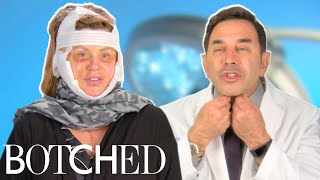 Dr Nassif Fixes Lisa’s Facelift Gone Wrong FULL TRANSFORMATION  Botched  E [upl. by Mathilde]