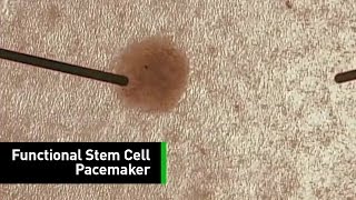 Scientists Develop The First Biological Pacemaker From Stem Cells [upl. by Naols]