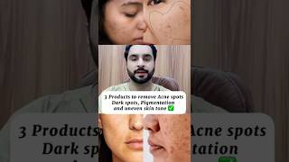 3 products to remove Acne spots Dark spots Pigmentation Uneven skin tone skincaretipsofficial [upl. by Ytiak]