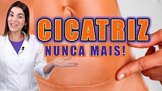 Adeus CICATRIZ no Rosto e no Corpo  Saiba como TRATAR e PREVENIR CICATRIZES [upl. by Dona]