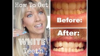 ❤ How To Get WHITE Teeth at Home Demo amp Actual Pictures ❤ [upl. by Adnamma]