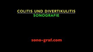 076  Sonografie  Colitis und Divertikulitis [upl. by Henrique]