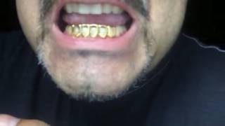 Fitting 6 Open Face Teeth Grillz [upl. by Ayak]