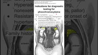 Indications for diagnostic testing for pheochromocytoma [upl. by Loftus97]