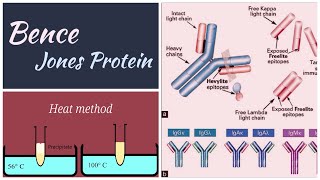 Bence jones protein  multiple myeloma  Methodspathologypathologylabbiochemistry bjp [upl. by Isaak]