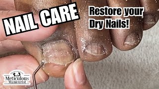 Nail Care Dry Toenails nails satisfying 🤤 [upl. by Ihcelek]