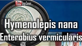 Enterobius vermicularis larva adulta y huevos y Hymenolepis nanahuevosExamen de heces [upl. by Noeled]