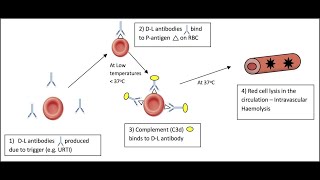 Paroxysmal Cold hemoglobinuria  Donath Landsteiner Hemolytic Anemia or Syndrome [upl. by Ytiak]