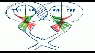 OPTHALMOLOGY LECTURES Neuro ophthalmology VISUAL PATHWAY part 2 [upl. by Nayve]