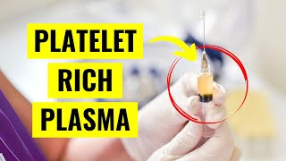 Platelet Rich Plasma PRP Injections Everything You Need to Know [upl. by Ennayelhsa]