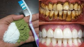 आपके गंदे पीले दाँतो को 2 मिनट में मोतियों जैसा सफ़ेद और चमकदार बना देगा  magical teeth whitening [upl. by Airamesor]